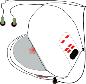 VCDs